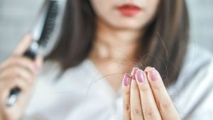 Hair loss has been identified as a surprising side effect of Coronavirus