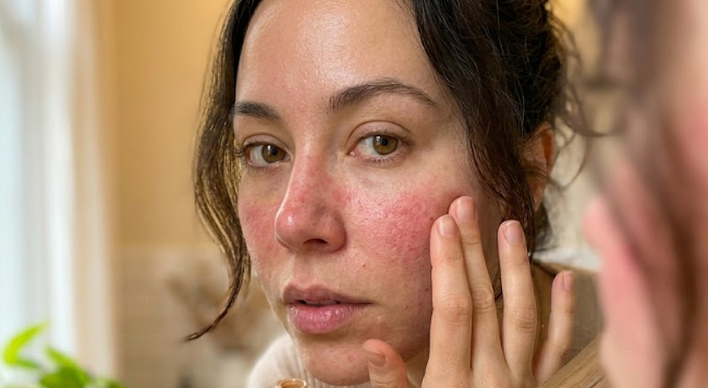 Makeup for Compromised Skin Barrier: 7 Dermatologist-Backed Rules in 2026